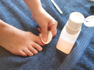 Get off the old nail polish that you’ve got on your feet | arujogi