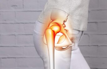 Hip Pain and Latest Pain Relief Options