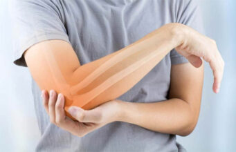 How to Communicate Regarding Your Joint Pain To Your Doctor?